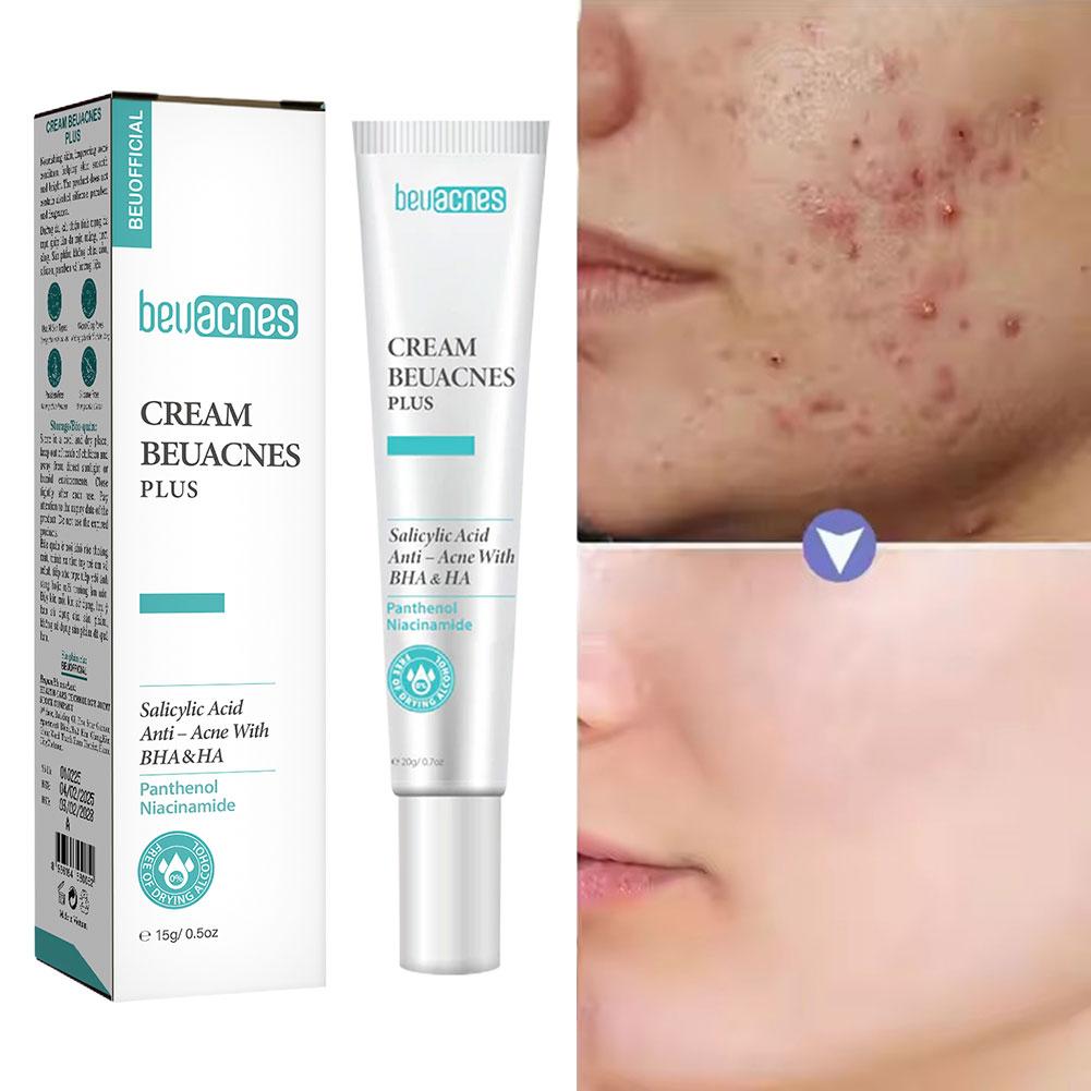 Skincare Niacinamide - 새로운 20g 니아신 아미드 여드름 젤