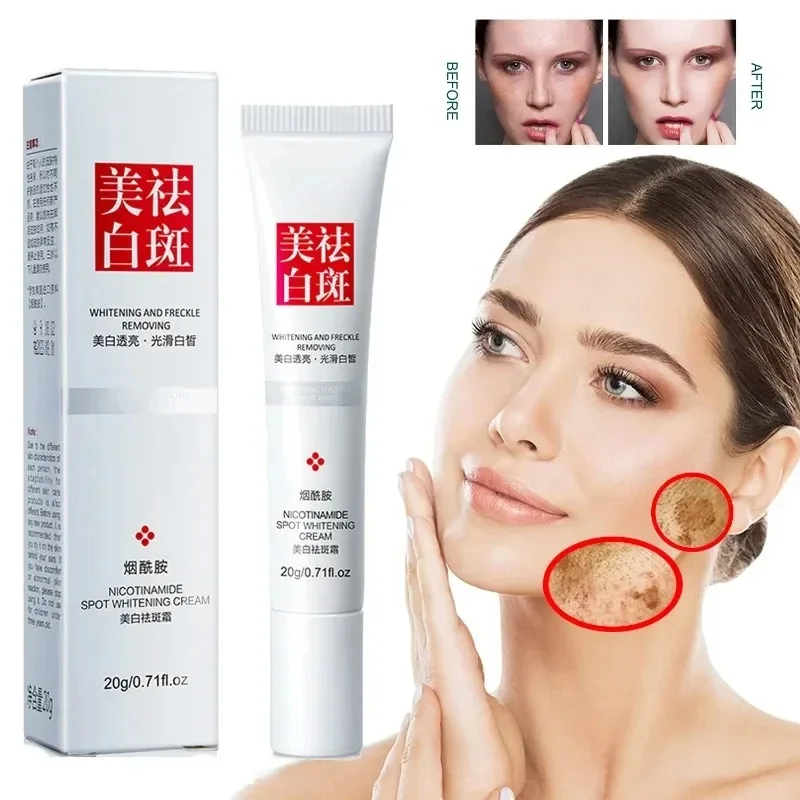 Skincare Niacinamide - 페이드 주근깨 다크 스팟 페이스 크림,