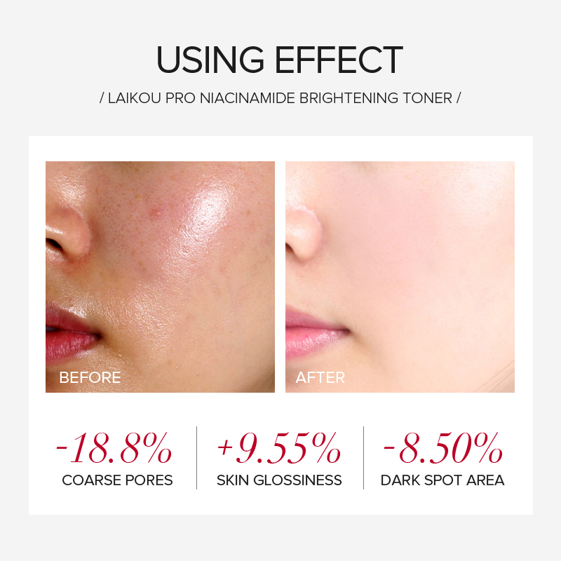라이코우 프로 나이아신아마이드 4종 브라이트닝 스킨케어 - Skincare Niacinamide 리뷰 및 가격