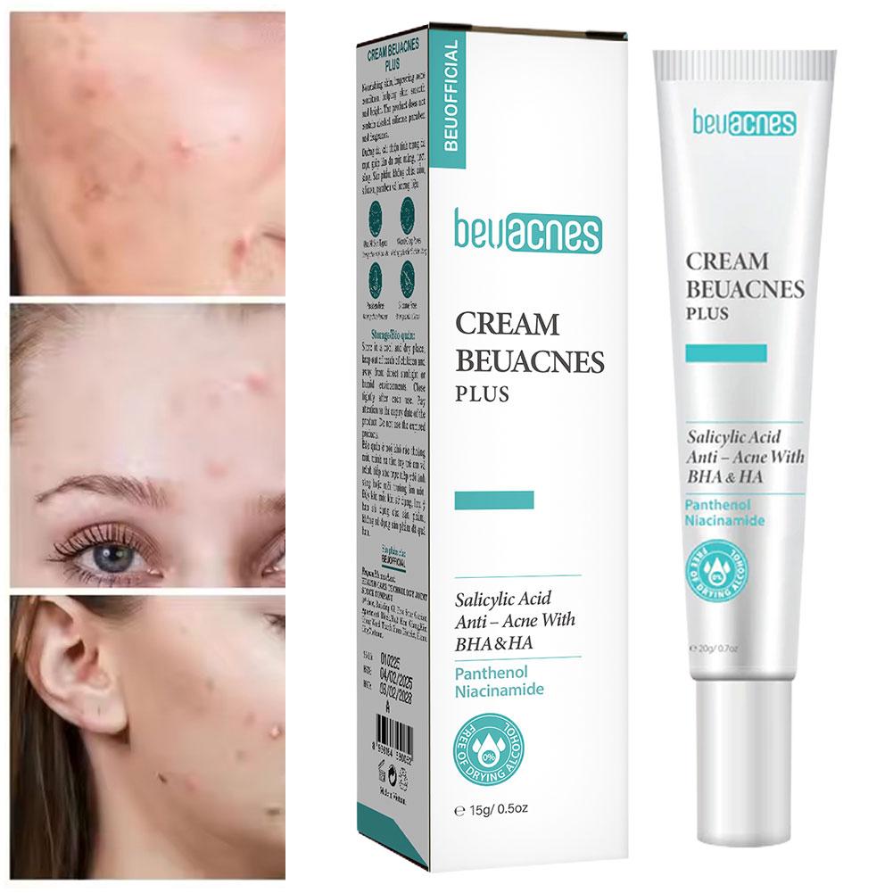 새로운 20g 니아신 아미드 여드름 젤 안티 여드름 살 - Skincare Niacinamide 리뷰 및 가격