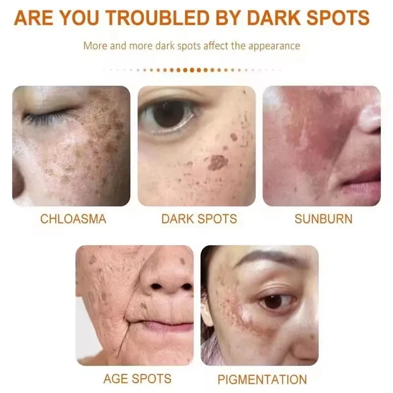 미백 주근깨 크림 얼굴 브라이트닝 크림 나이아신아마이드 - Skincare Niacinamide 리뷰 및 가격