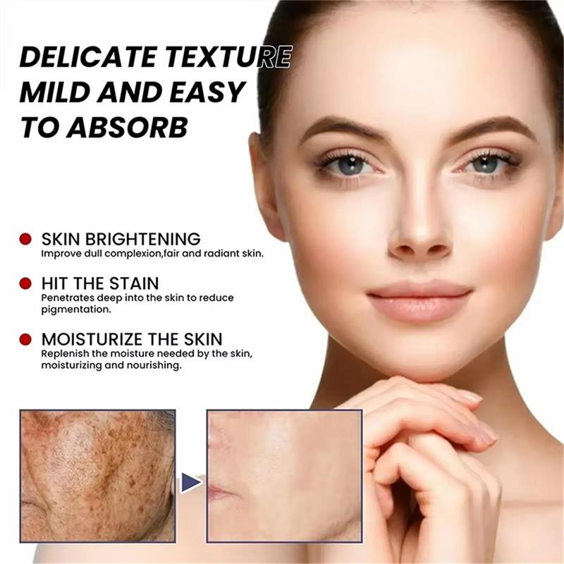 미백 주근깨 크림 얼굴 브라이트닝 크림 나이아신아마이드 - Skincare Niacinamide 리뷰 및 가격